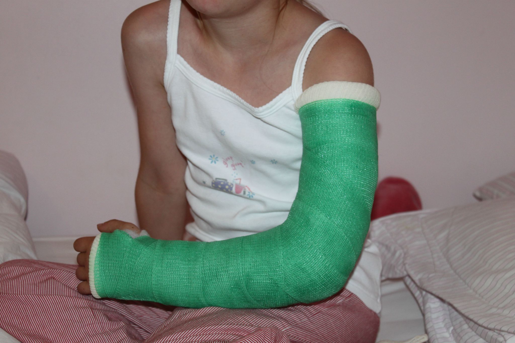 Le truc infaillible contre les coups de soleil! La tête dans le guidon!