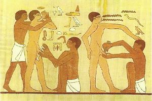 Circoncision Egypt
